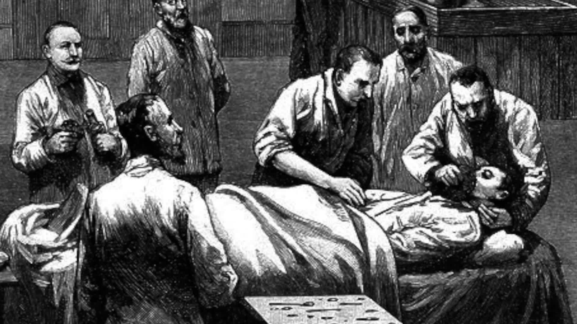 Alzheimers Disease: Insulin Resistance and Nutrition